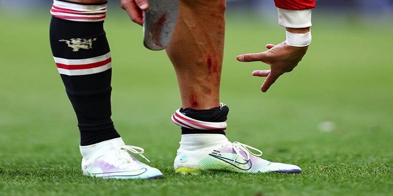 Chấn thương mắt cá của Cristiano Ronaldo