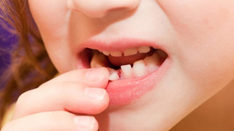 Mơ thấy rụng răng là điềm báo gì?