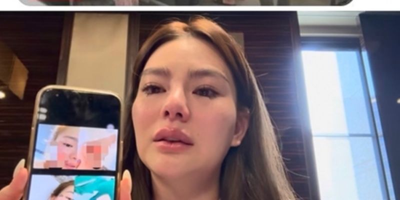 Ngôi sao nữ đau lòng kể lại vụ việc bị bạo hành bởi người yêu cũ