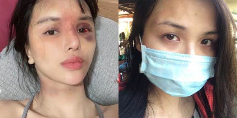 Cần ngăn chặn những vụ việc liên quan đến bạo hành tinh thần của phái nữ